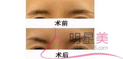 來(lái)例假第四天可以紋眉毛嗎