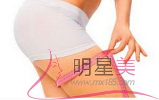 怎樣才能減掉大腿和肚子上的贅肉