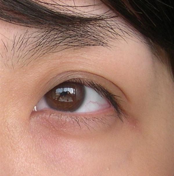 <a href=http://www.bolangguoji.com/listinfo-782-0.html target=_blank class=infotextkey>去眼角細紋</a>失敗修復價格