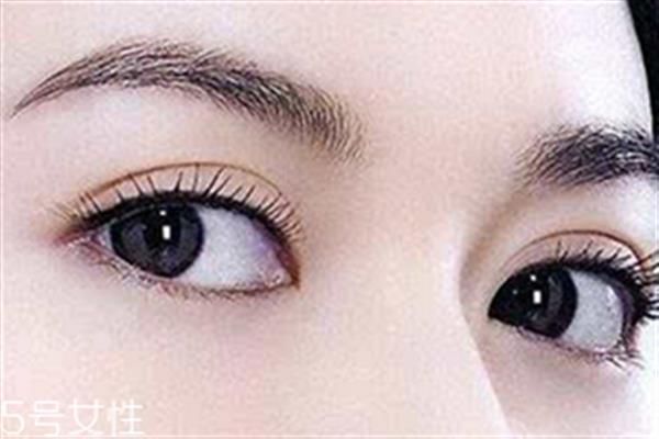割<a href=http://www.bolangguoji.com/listinfo-724-0.html target=_blank class=infotextkey>雙眼皮</a>眼睛腫怎么辦？疤克可以預防疤痕增生