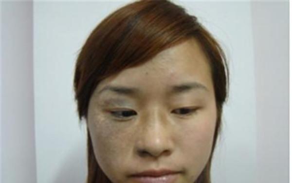 做<a href=http://www.bolangguoji.com/listinfo-799-0.html target=_blank class=infotextkey>去太田痣</a>價格多少錢