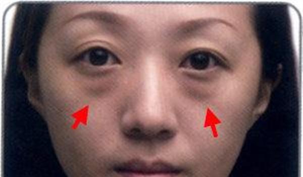 做微晶磨皮<a href=http://www.bolangguoji.com/listinfo-782-0.html target=_blank class=infotextkey>去眼角細(xì)紋</a>風(fēng)險(xiǎn)有哪些
