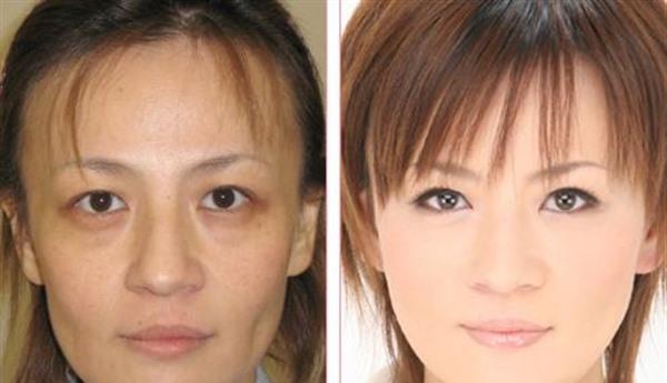 RV極速美塑美膚價格要多少？