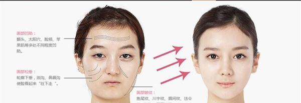 <a href=http://www.bolangguoji.com/listinfo-764-0.html target=_blank class=infotextkey>面部年輕化</a>價格
