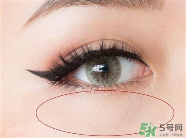 <a href=http://www.bolangguoji.com/listinfo-731-0.html target=_blank class=infotextkey>玻尿酸</a>填充淚溝多久恢復自然？<a href=http://www.bolangguoji.com/listinfo-731-0.html target=_blank class=infotextkey>玻尿酸</a>填充淚溝的危害