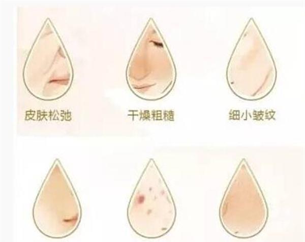 水光娃娃適應癥狀是什么？
