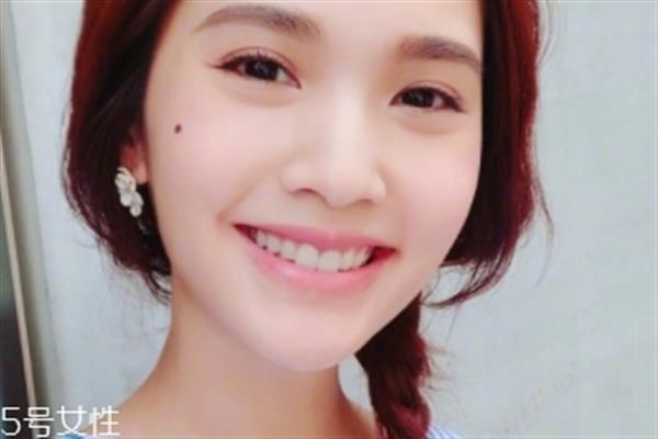 點(diǎn)痣能吃魚嗎 魚屬于發(fā)物