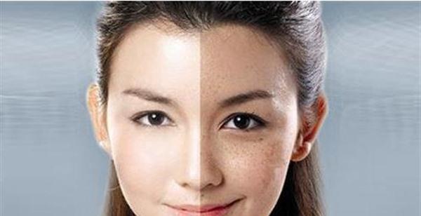 激光<a href=http://www.bolangguoji.com/listinfo-795-0.html target=_blank class=infotextkey>祛斑</a>手術(shù)的方法是什么？