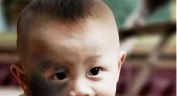 做激光<a href=http://www.bolangguoji.com/listinfo-799-0.html target=_blank class=infotextkey>去太田痣</a>要花多長時間