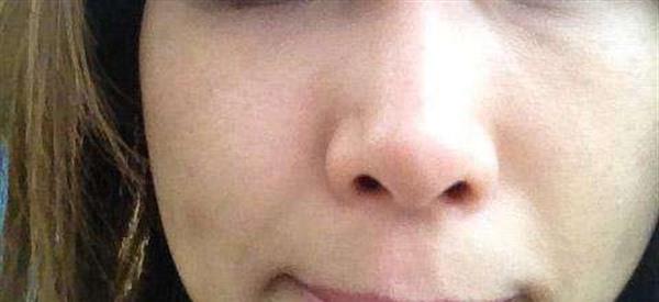 做彩光<a href=http://www.bolangguoji.com/listinfo-795-0.html target=_blank class=infotextkey>祛斑</a>風險有哪些