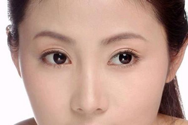 做<a href=http://www.bolangguoji.com/listinfo-724-0.html target=_blank class=infotextkey>雙眼皮</a>重瞼術有什么危害 重瞼術有哪些治療方法