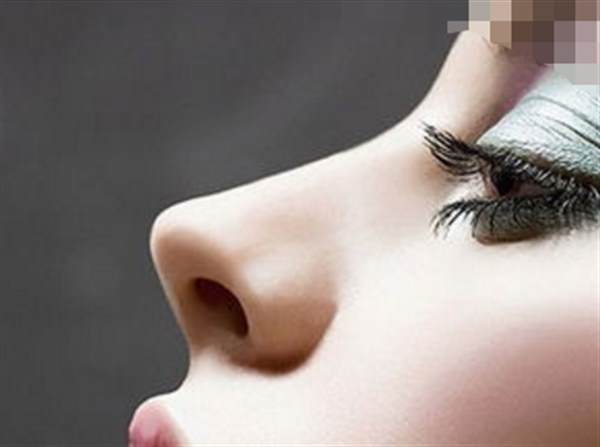自體脂肪<a href=http://www.bolangguoji.com/listinfo-737-0.html target=_blank class=infotextkey>隆鼻</a>案例分享