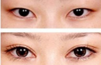 <a href=http://www.bolangguoji.com/listinfo-724-0.html target=_blank class=infotextkey>雙眼皮</a>貼一定會松弛嗎
