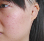 全<a href=http://www.bolangguoji.com/listinfo-699-0.html target=_blank class=infotextkey>耳再造</a>手術的禁忌癥有哪些