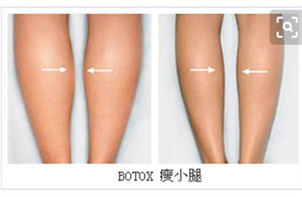 怎樣<a href=http://www.bolangguoji.com/listinfo-679-0.html target=_blank class=infotextkey>瘦小腿</a>有效