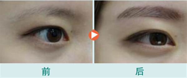<a href=http://www.bolangguoji.com/listinfo-657-0.html target=_blank class=infotextkey>繡眉</a>后多久可以變自然