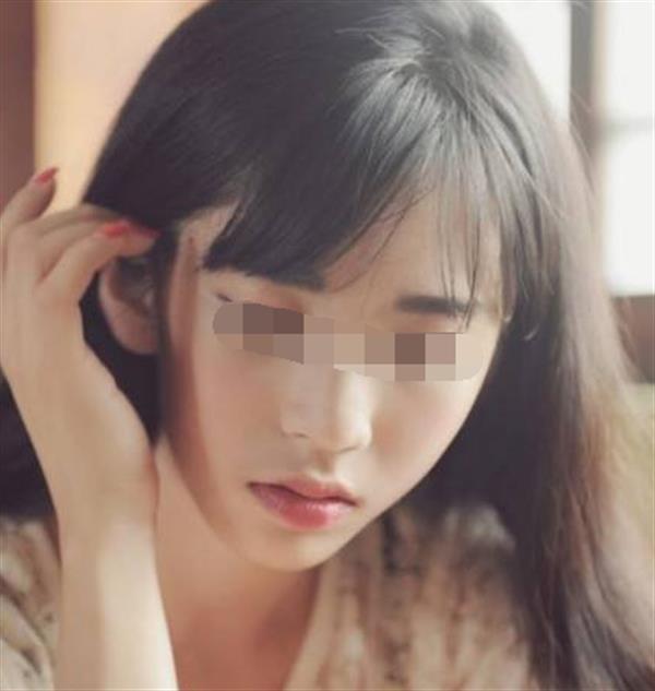 額部填充術后護理有哪些