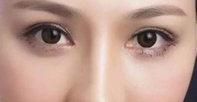 那些人不適合割<a href=http://www.bolangguoji.com/listinfo-724-0.html target=_blank class=infotextkey>雙眼皮</a>