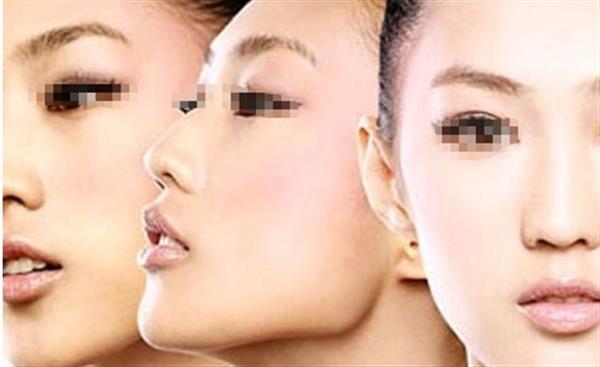 光子<a href=http://www.bolangguoji.com/listinfo-770-0.html target=_blank class=infotextkey>嫩膚</a>和激光美容區(qū)別