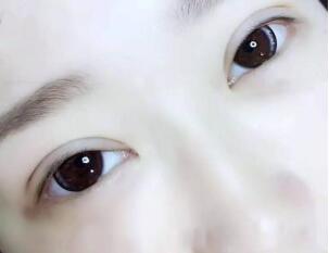 <a href=http://www.bolangguoji.com/listinfo-724-0.html target=_blank class=infotextkey>雙眼皮</a>手術術前注意事項