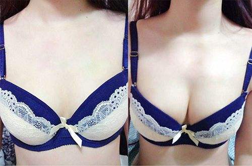硅膠假體<a href=http://www.bolangguoji.com/listinfo-618-0.html target=_blank class=infotextkey>隆胸</a>有哪些特點