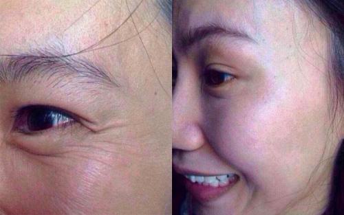 botox<a href=http://www.bolangguoji.com/listinfo-614-0.html target=_blank class=infotextkey>除皺</a>瘦型素<a href=http://www.bolangguoji.com/listinfo-614-0.html target=_blank class=infotextkey>除皺</a>瘦型素注射<a href=http://www.bolangguoji.com/listinfo-614-0.html target=_blank class=infotextkey>除皺</a>價格是多少錢