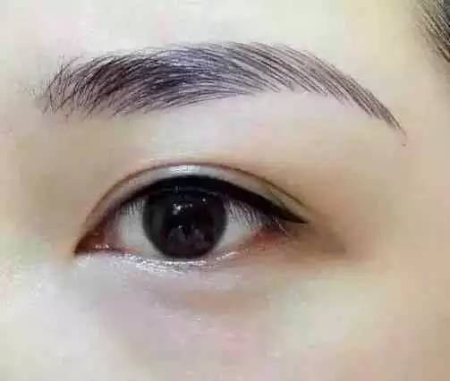 紋眉后癢幾天能好