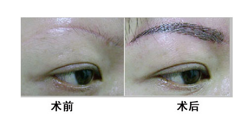 <a href=http://www.bolangguoji.com/listinfo-658-0.html target=_blank class=infotextkey>洗眉</a>后多久可以重新紋