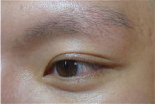 激光<a href=http://www.bolangguoji.com/listinfo-658-0.html target=_blank class=infotextkey>洗眉</a>多久可以紋眉