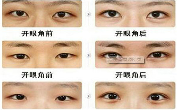 哪種眼睛適合<a href=http://www.bolangguoji.com/listinfo-711-0.html target=_blank class=infotextkey>開眼角</a>?