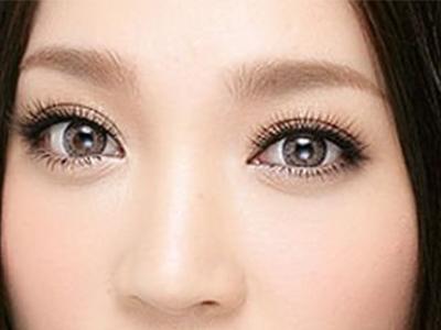 <a href=http://www.bolangguoji.com/listinfo-682-0.html target=_blank class=infotextkey>溶脂</a><a href=http://www.bolangguoji.com/listinfo-708-0.html target=_blank class=infotextkey>去眼袋</a>好不好呢