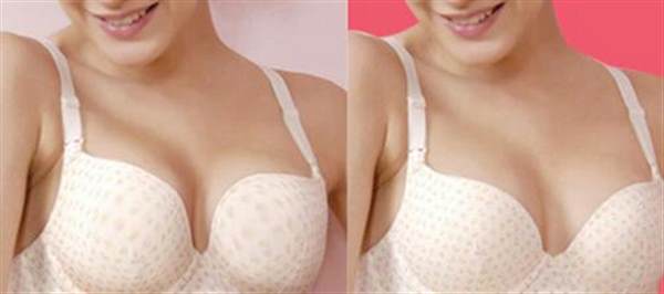 自體脂肪<a href=http://www.bolangguoji.com/listinfo-618-0.html target=_blank class=infotextkey>隆胸</a>多少錢