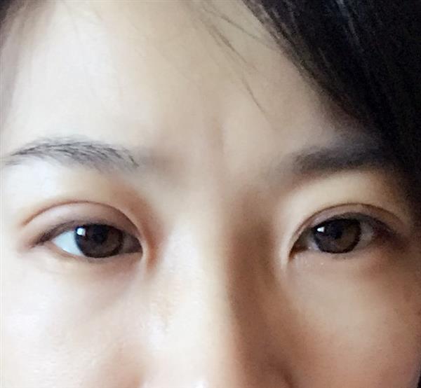 割了<a href=http://www.bolangguoji.com/listinfo-724-0.html target=_blank class=infotextkey>雙眼皮</a>多久能紋眉嗎