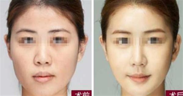 吃<a href=http://www.bolangguoji.com/listinfo-687-0.html target=_blank class=infotextkey>減肥</a>藥能打<a href=http://www.bolangguoji.com/listinfo-631-0.html target=_blank class=infotextkey>瘦臉</a><a href=http://www.bolangguoji.com/listinfo-614-0.html target=_blank class=infotextkey>除皺</a>嗎