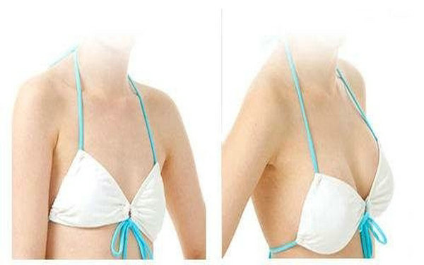 假體<a href=http://www.bolangguoji.com/listinfo-618-0.html target=_blank class=infotextkey>隆胸</a>答疑解惑