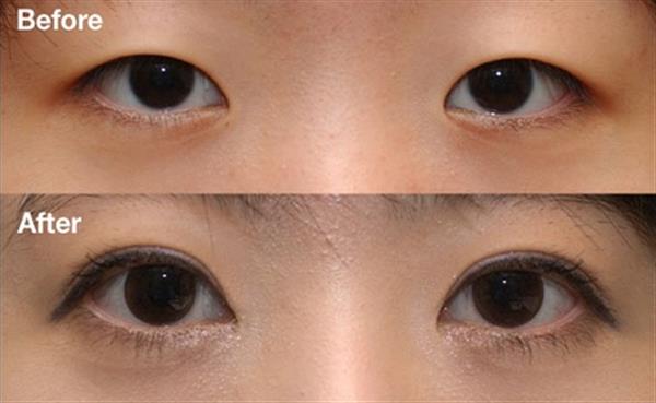 <a href=http://www.bolangguoji.com/listinfo-724-0.html target=_blank class=infotextkey>雙眼皮</a>加<a href=http://www.bolangguoji.com/listinfo-711-0.html target=_blank class=infotextkey>開眼角</a>多少錢
