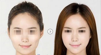 <a href=http://www.bolangguoji.com/listinfo-631-0.html target=_blank class=infotextkey>瘦臉</a><a href=http://www.bolangguoji.com/listinfo-614-0.html target=_blank class=infotextkey>除皺</a>多久有明顯效果