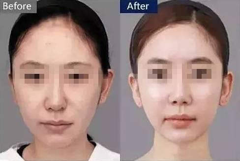 打一次水光<a href=http://www.bolangguoji.com/listinfo-770-0.html target=_blank class=infotextkey>嫩膚</a>要多少錢