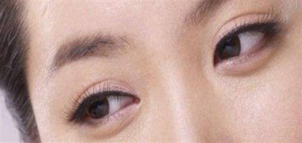 眼皮打透明質酸可以打成<a href=http://www.bolangguoji.com/listinfo-724-0.html target=_blank class=infotextkey>雙眼皮</a>嗎