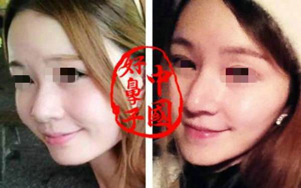 做膨體<a href=http://www.bolangguoji.com/listinfo-737-0.html target=_blank class=infotextkey>隆鼻</a>手術多少錢？