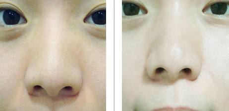 做彩光<a href=http://www.bolangguoji.com/listinfo-770-0.html target=_blank class=infotextkey>嫩膚</a>要多少錢