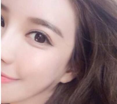 <a href=http://www.bolangguoji.com/listinfo-690-0.html target=_blank class=infotextkey>自體脂肪填充</a>蘋果肌多少錢