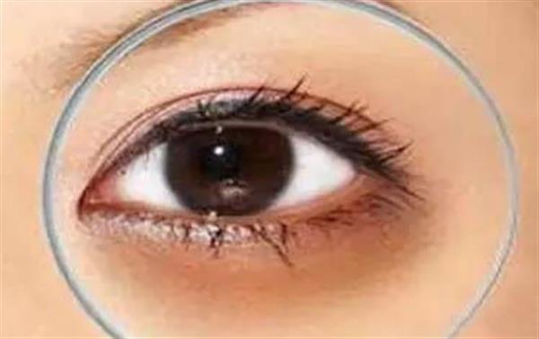 全切<a href=http://www.bolangguoji.com/listinfo-724-0.html target=_blank class=infotextkey>雙眼皮</a>手術術后怎么護理