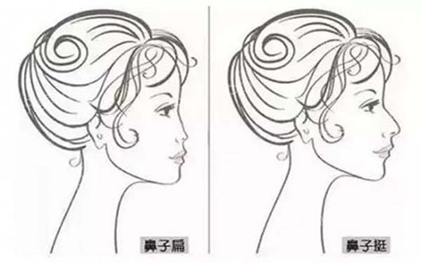 假體<a href=http://www.bolangguoji.com/listinfo-737-0.html target=_blank class=infotextkey>隆鼻</a>術的四個誤區有哪些？
