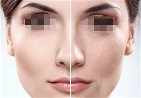 彩光<a href=http://www.bolangguoji.com/listinfo-770-0.html target=_blank class=infotextkey>嫩膚</a>后的注意事項有哪些