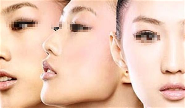 哪些人不適合進行光子<a href=http://www.bolangguoji.com/listinfo-770-0.html target=_blank class=infotextkey>嫩膚</a>
