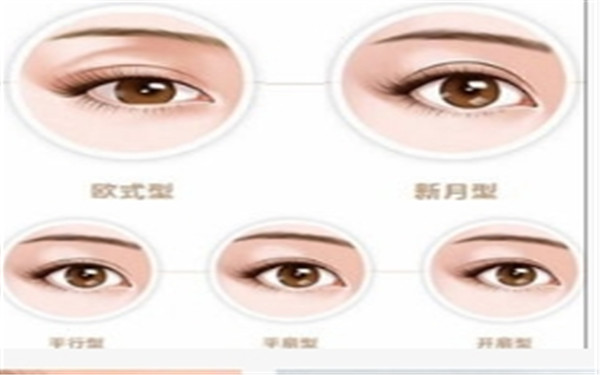  <a href=http://www.bolangguoji.com/listinfo-724-0.html target=_blank class=infotextkey>雙眼皮</a>修復(fù)有哪些原則