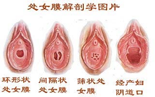 做<a href=http://www.bolangguoji.com/listinfo-800-0.html target=_blank class=infotextkey>私密整形</a>手術多少錢?