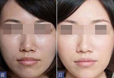 水光<a href=http://www.bolangguoji.com/listinfo-770-0.html target=_blank class=infotextkey>嫩膚</a>反黑多久能恢復