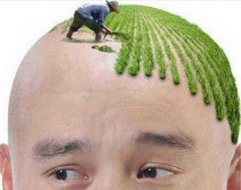 植發后幾天毛囊穩固了